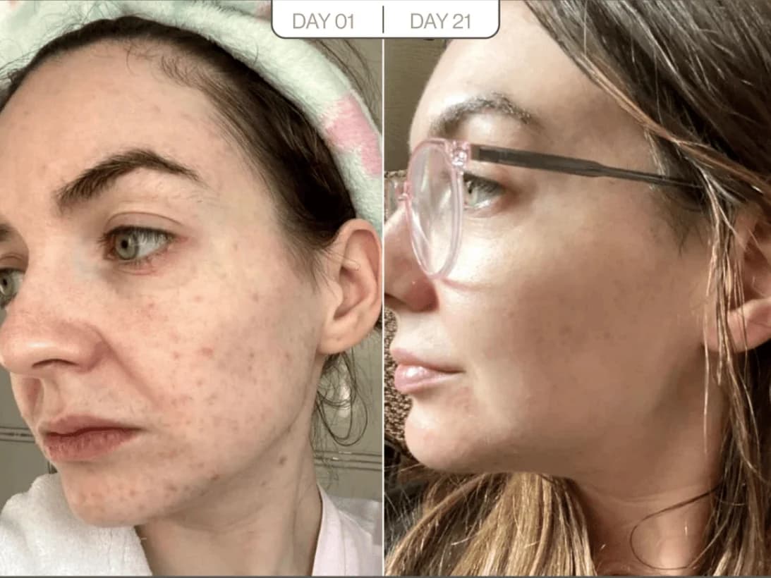 Skin Radiance