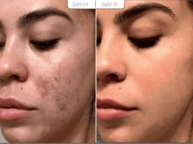 Skin Texture